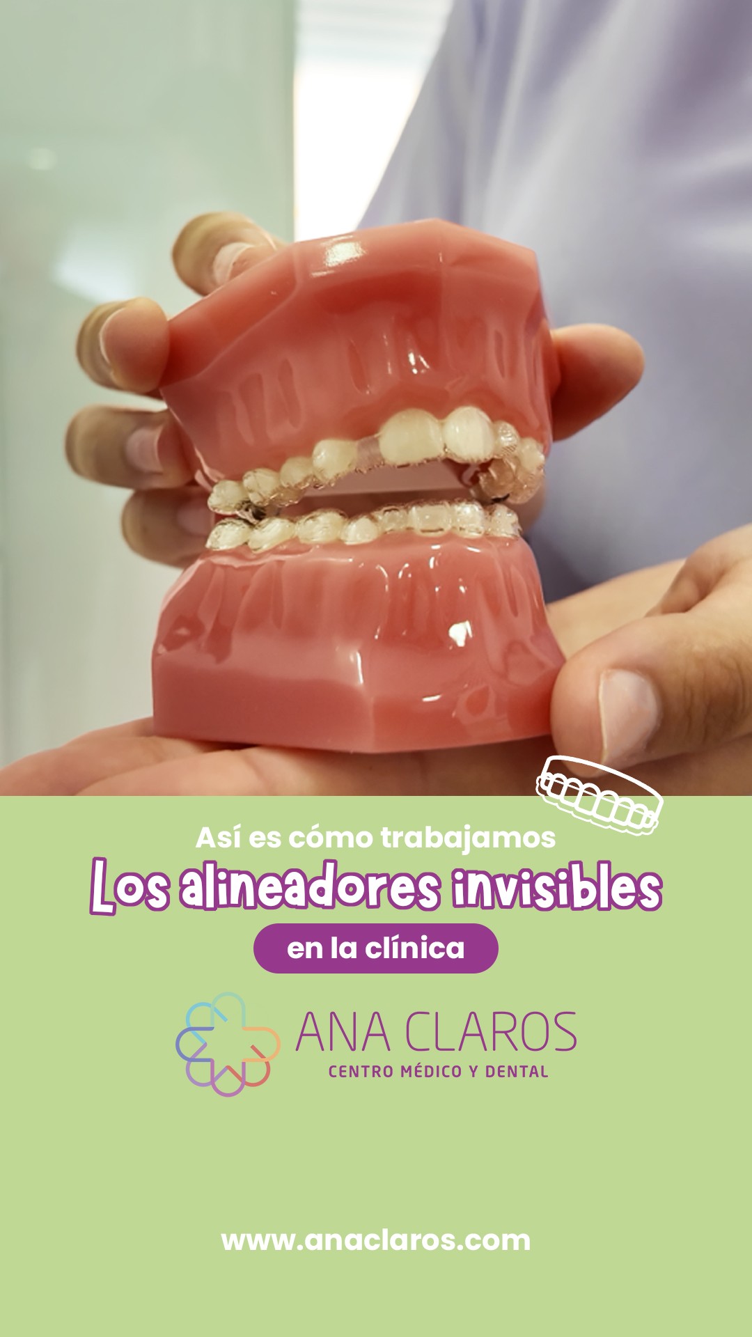 Invisalign