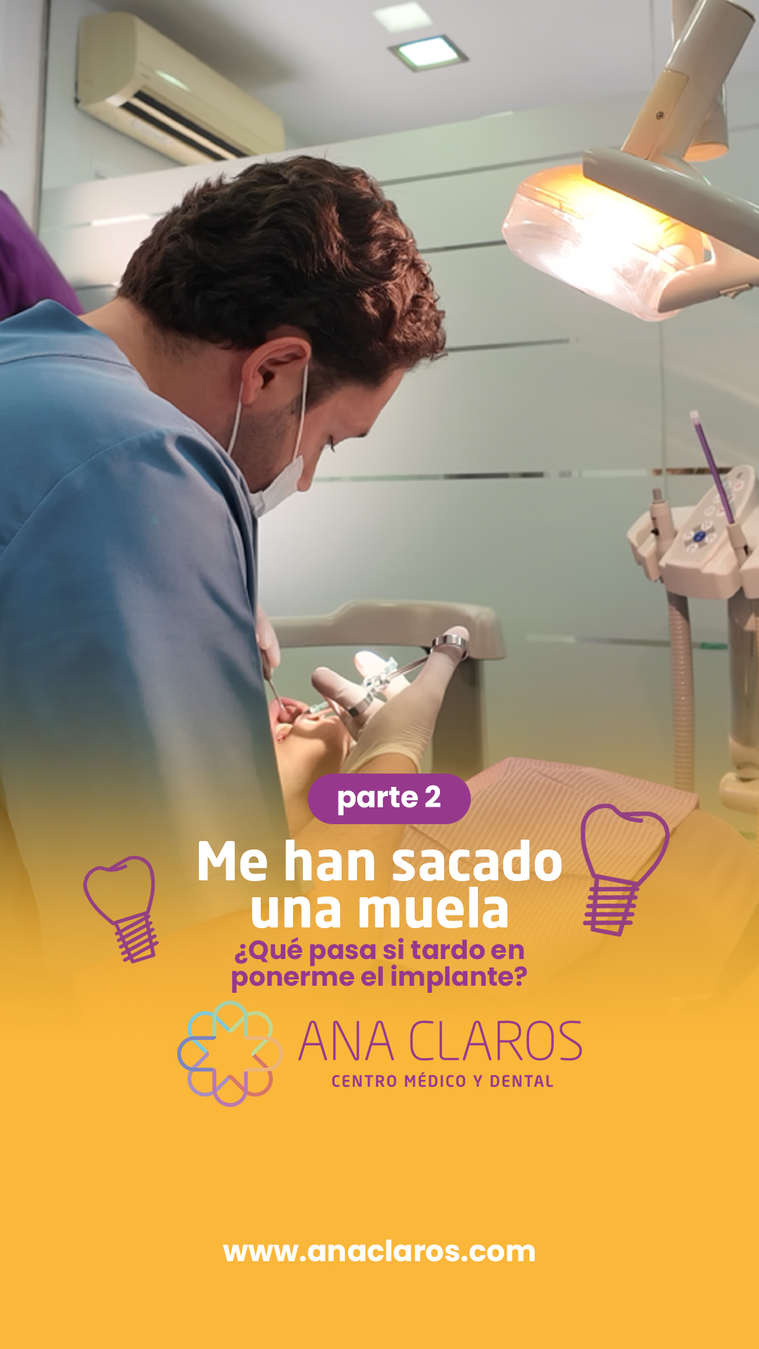 implantes parte 2